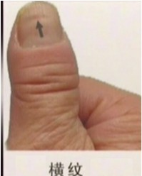 大病之前的征兆 大病之前的征兆