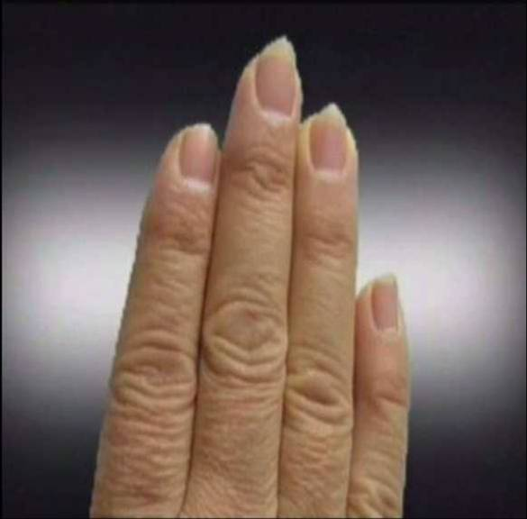 大病之前的征兆 大病之前的征兆